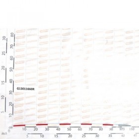 INDICATIN BAR